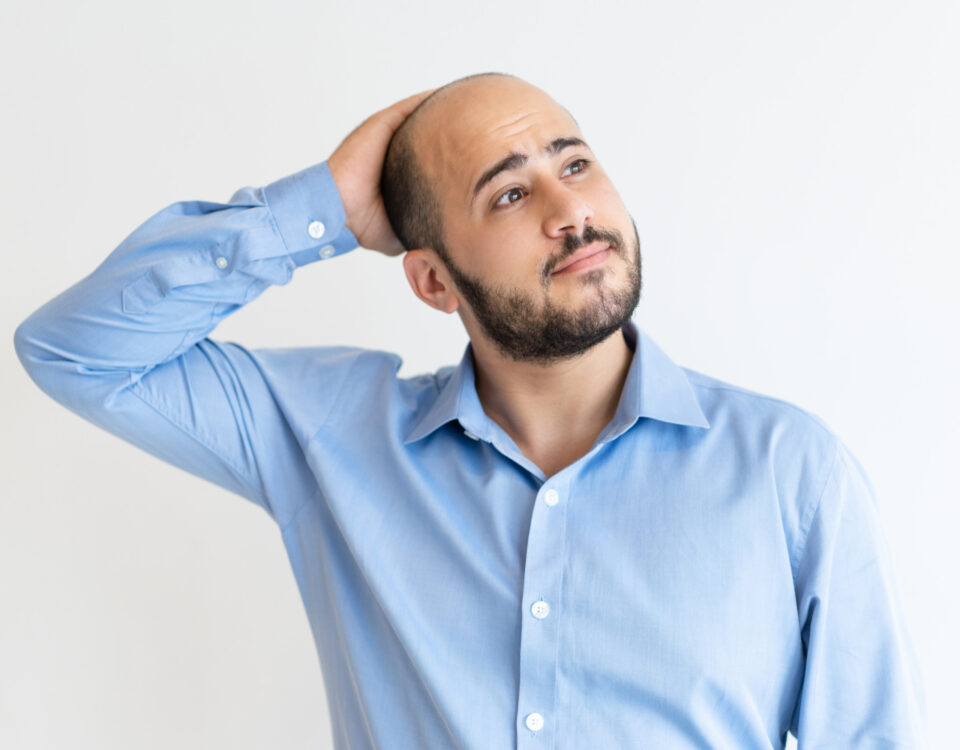 O que realmente funciona contra a calvície? O que realmente funciona contra a calvície?