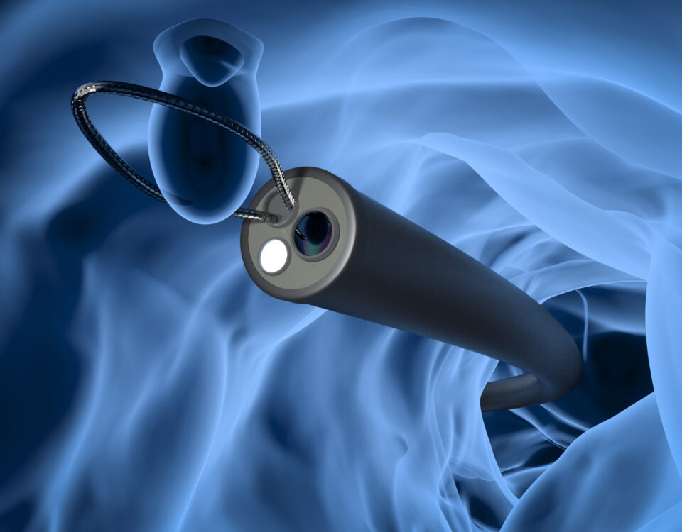 Como a endoscopia evoluiu ao longo dos anos? Como a endoscopia evoluiu ao longo dos anos?