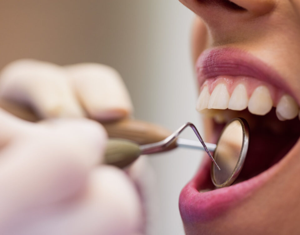 Como escolher dentista em Pirituba com confiança? Como escolher dentista em Pirituba com confiança?