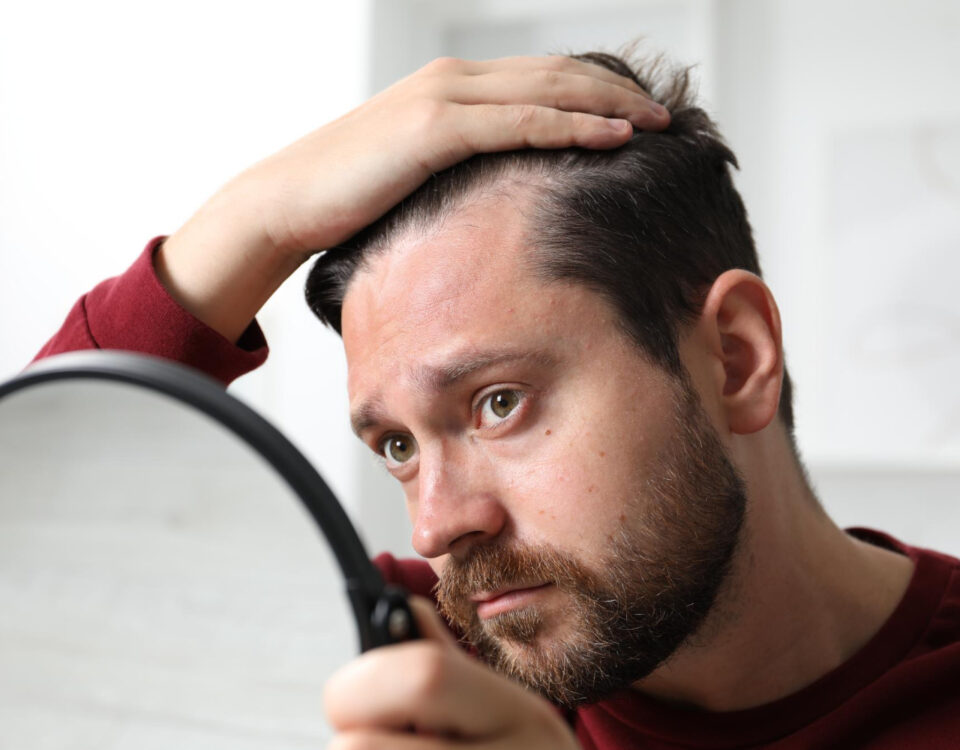 O que muda na autoestima após um transplante capilar